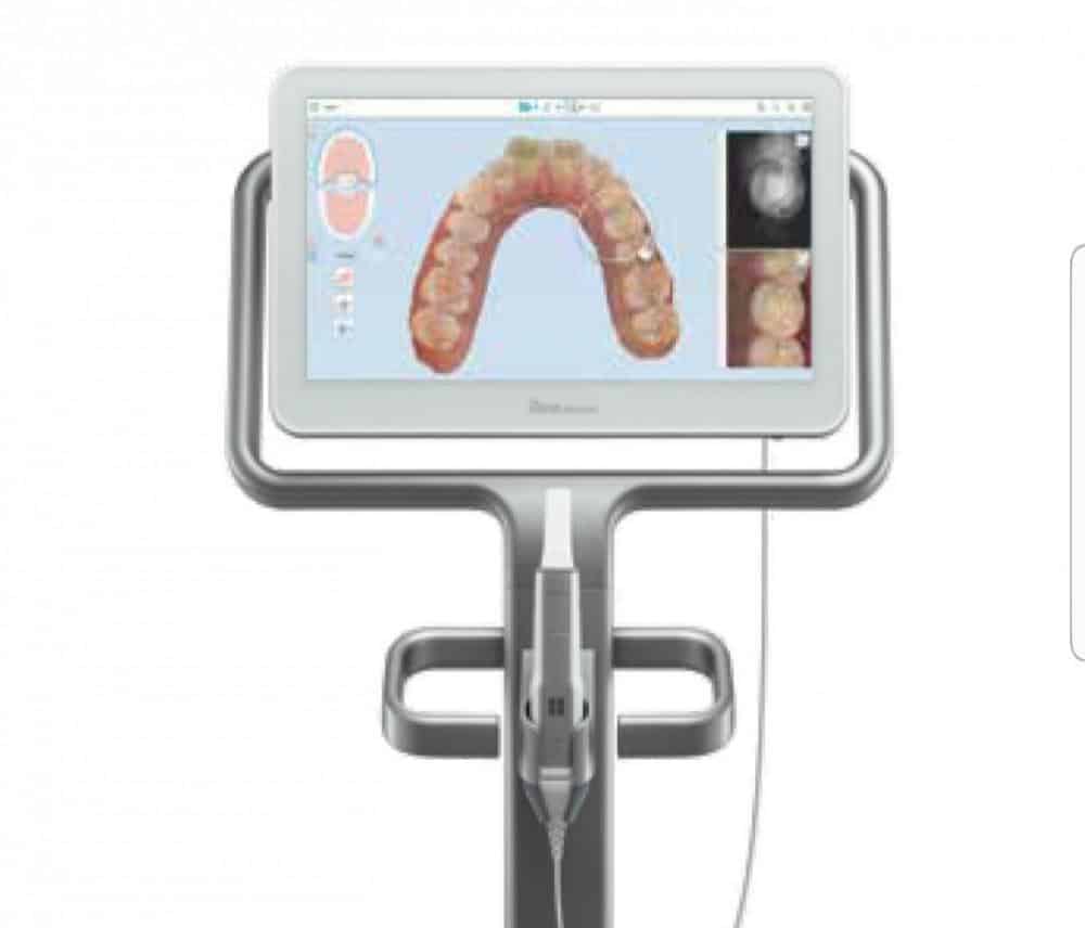 intra oral scanners
