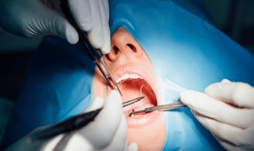 The Role of Oral Surgery in Correcting Jaw Misalignment and Bite Issues