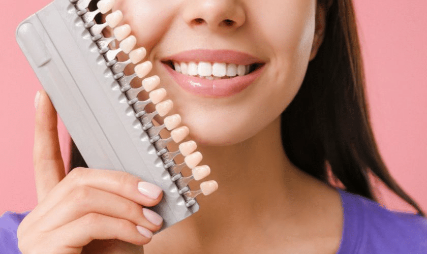 Veneers Aftercare: Expert Tips for Long-lasting Results