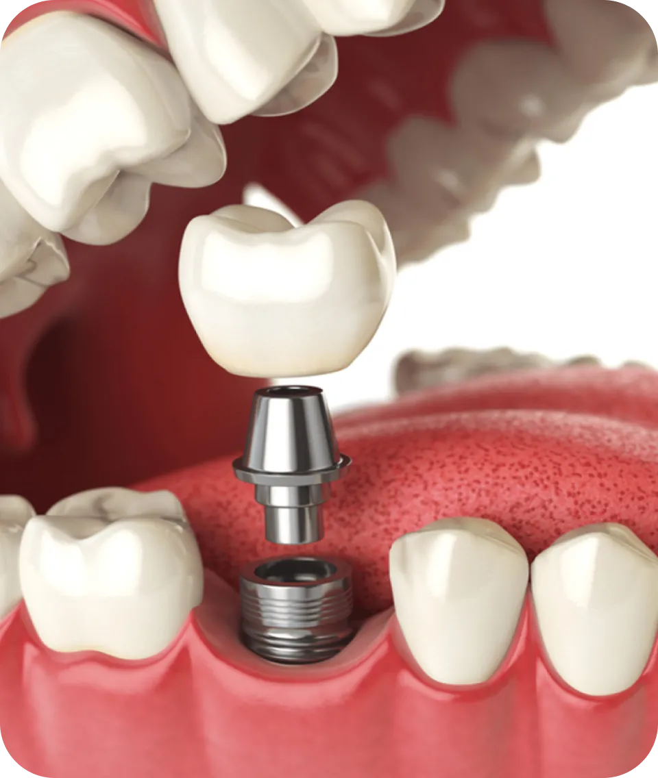 Westwood Dental Esthetics