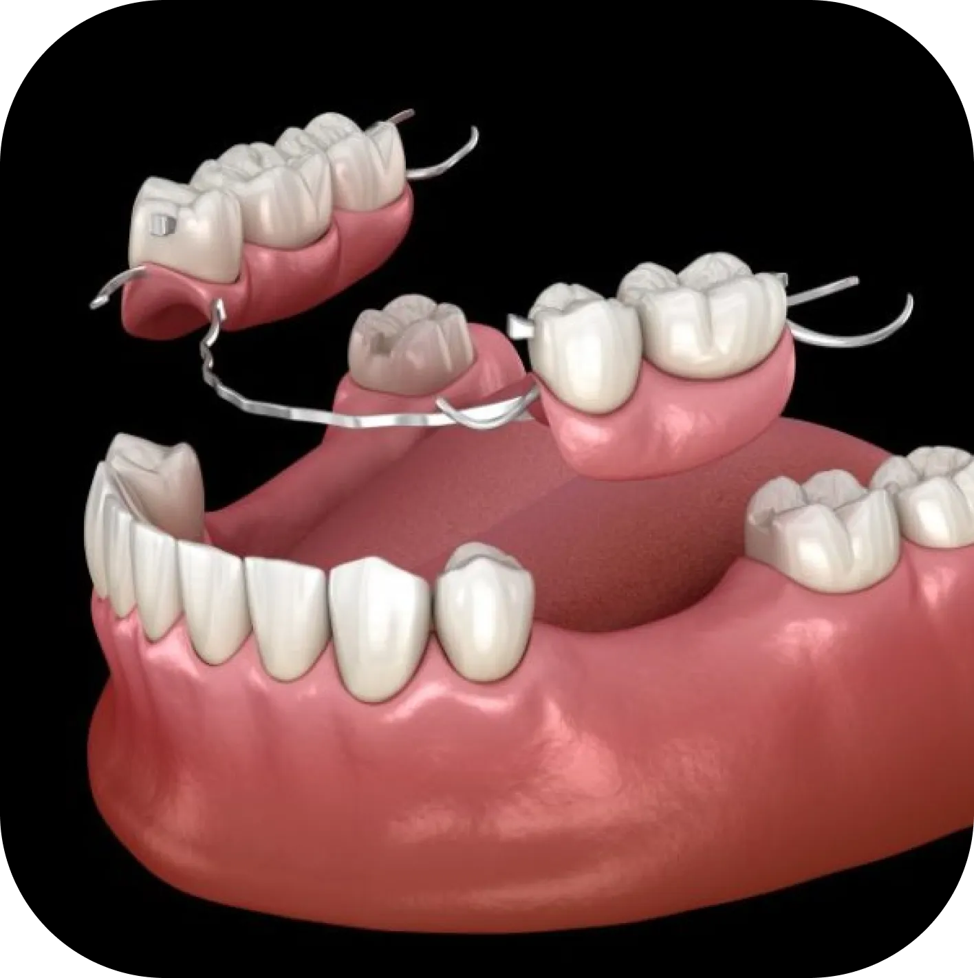Westwood Dental Esthetics