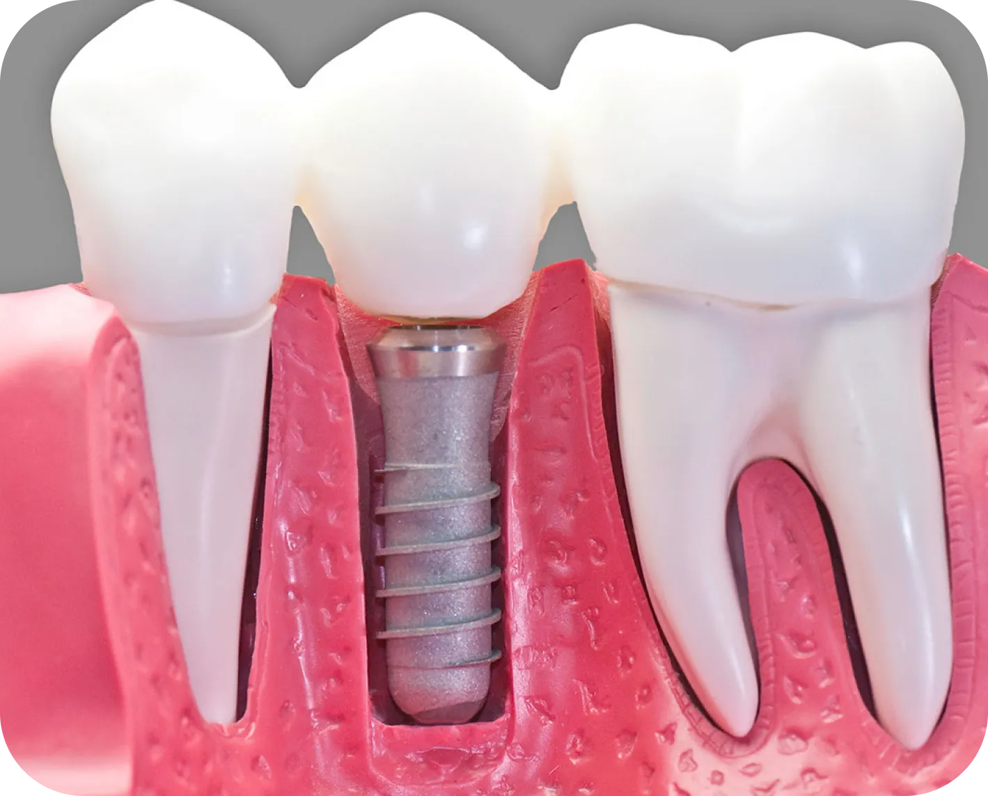 Westwood Dental Esthetics