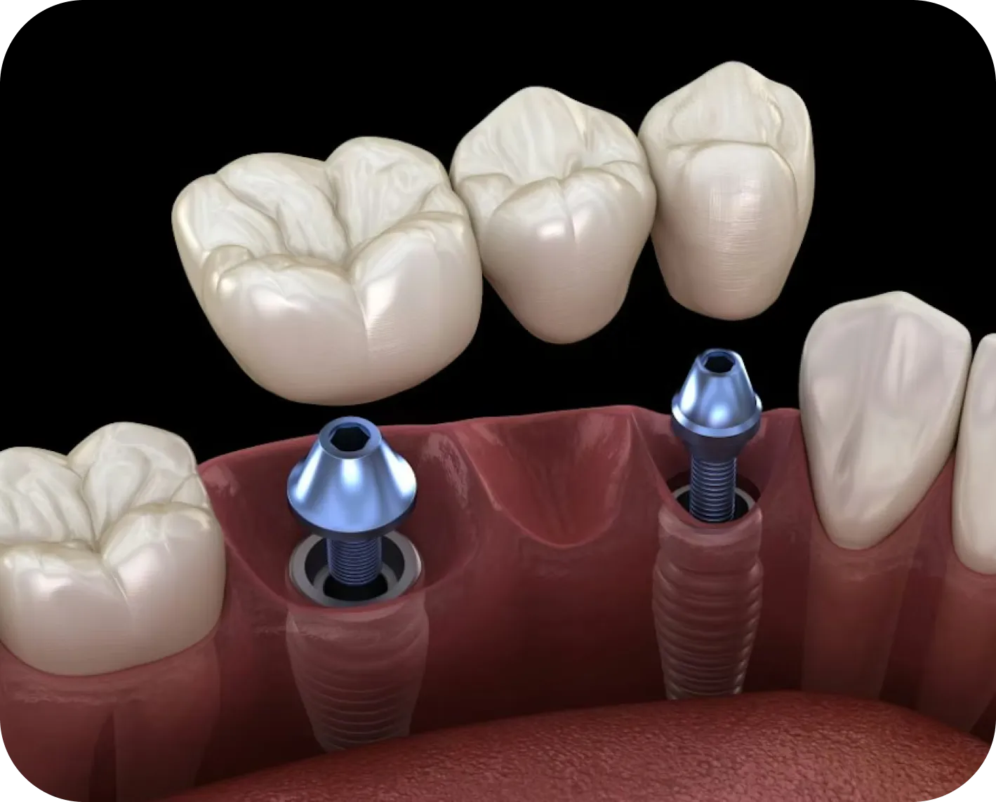 Westwood Dental Esthetics