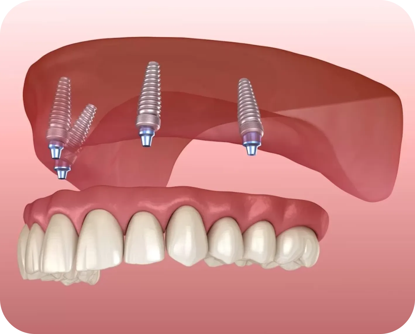 Westwood Dental Esthetics
