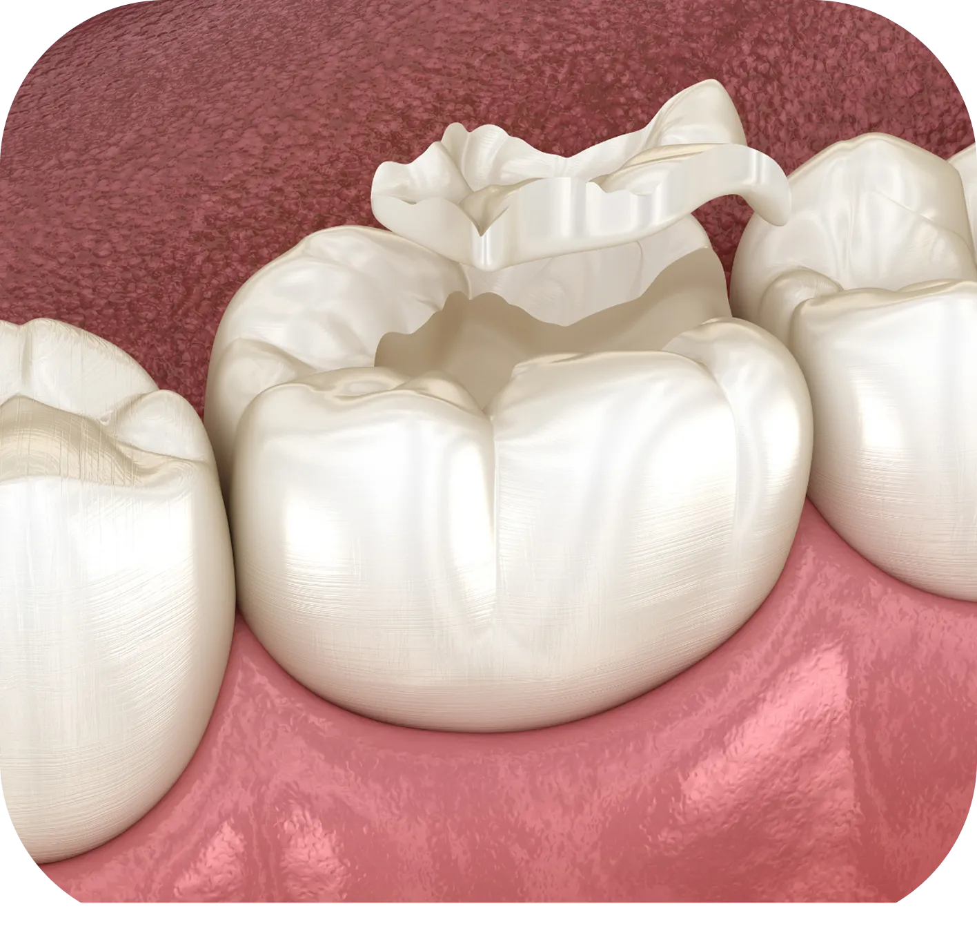 Westwood Dental Esthetics