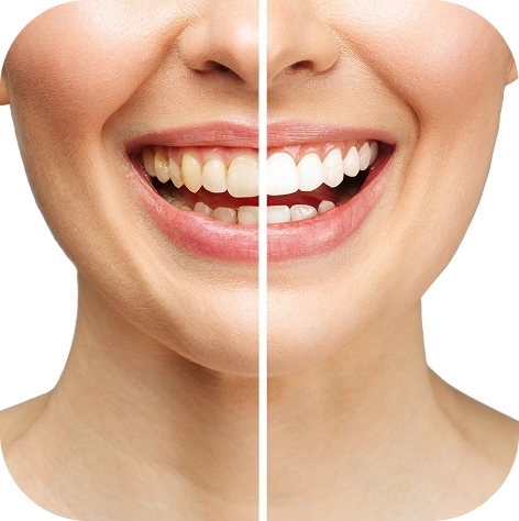 Westwood Dental Esthetics