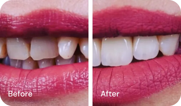 Westwood Dental Esthetics