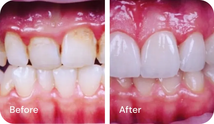 Westwood Dental Esthetics