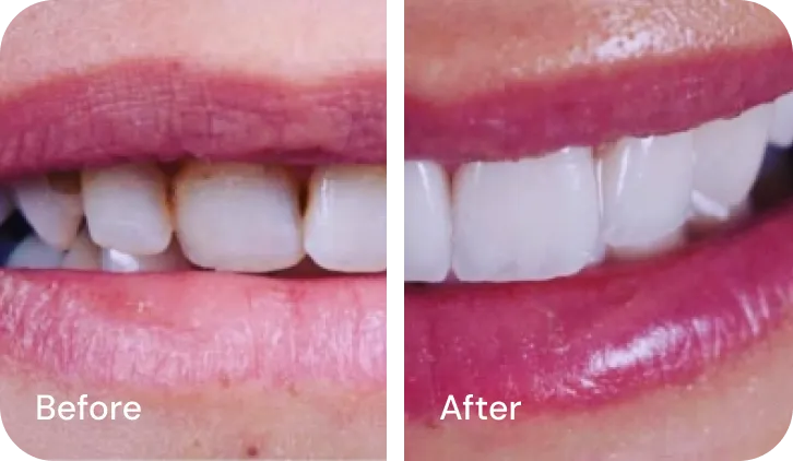 Westwood Dental Esthetics