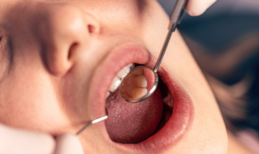 How to Recognize and Treat Oral Infections- Signs and Symptoms