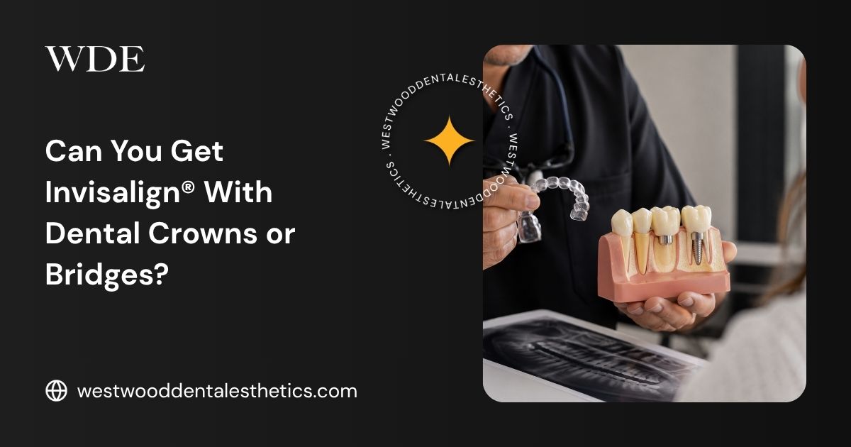 Dentist holding a clear aligner and a dental model with crowns and an implant while explaining Invisalign treatment options for restored teeth.