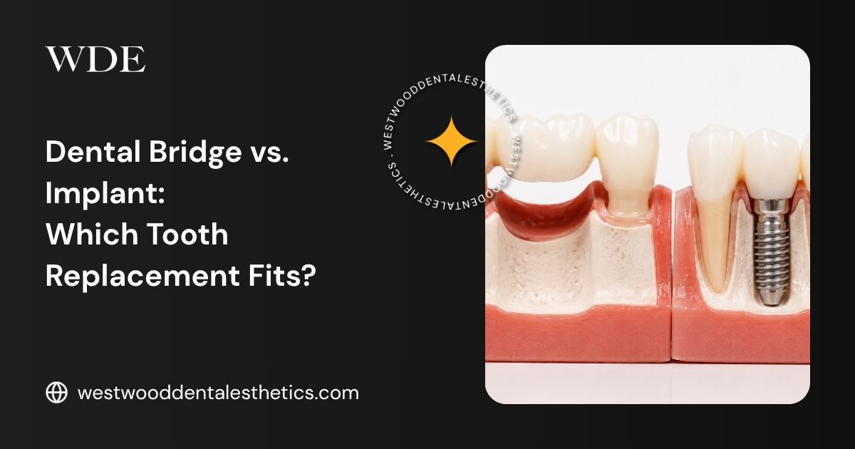 Dental model illustrating the difference between a dental bridge and a single tooth implant.