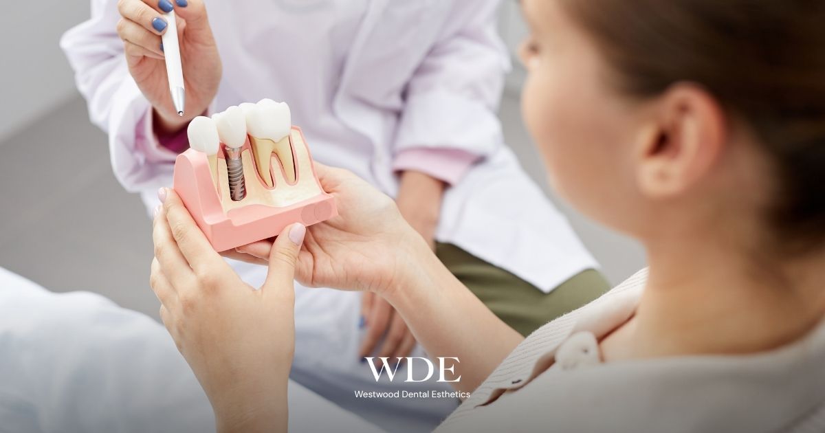 Dentist explaining the differences between a dental bridge and a dental implant using an educational tooth model during a treatment consultation.