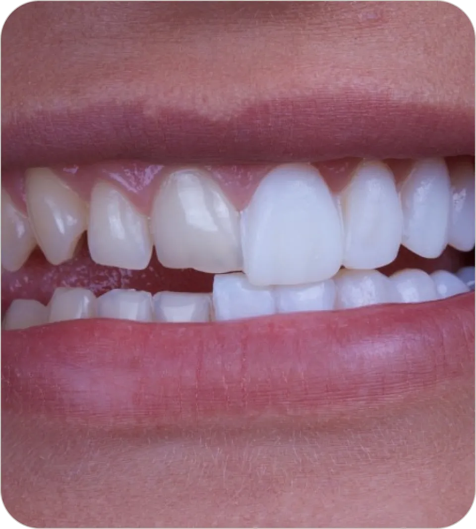 Westwood Dental Esthetics