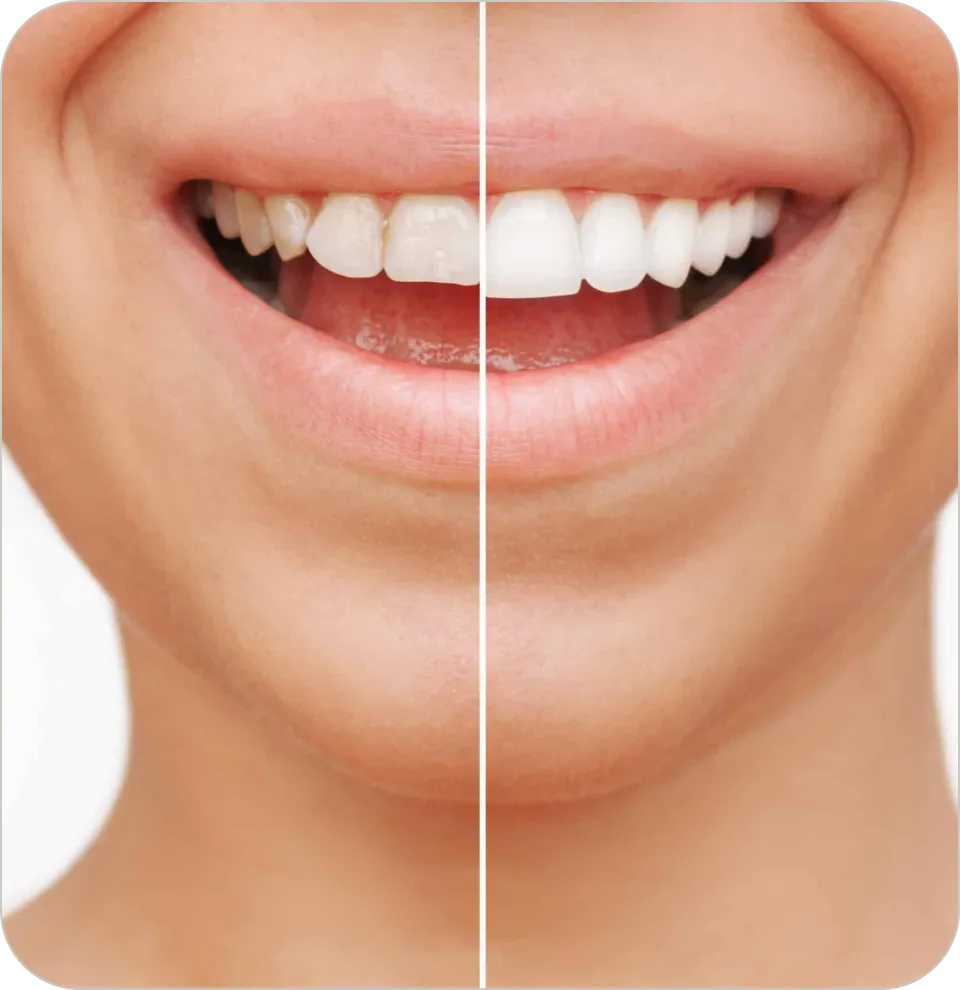 Westwood Dental Esthetics