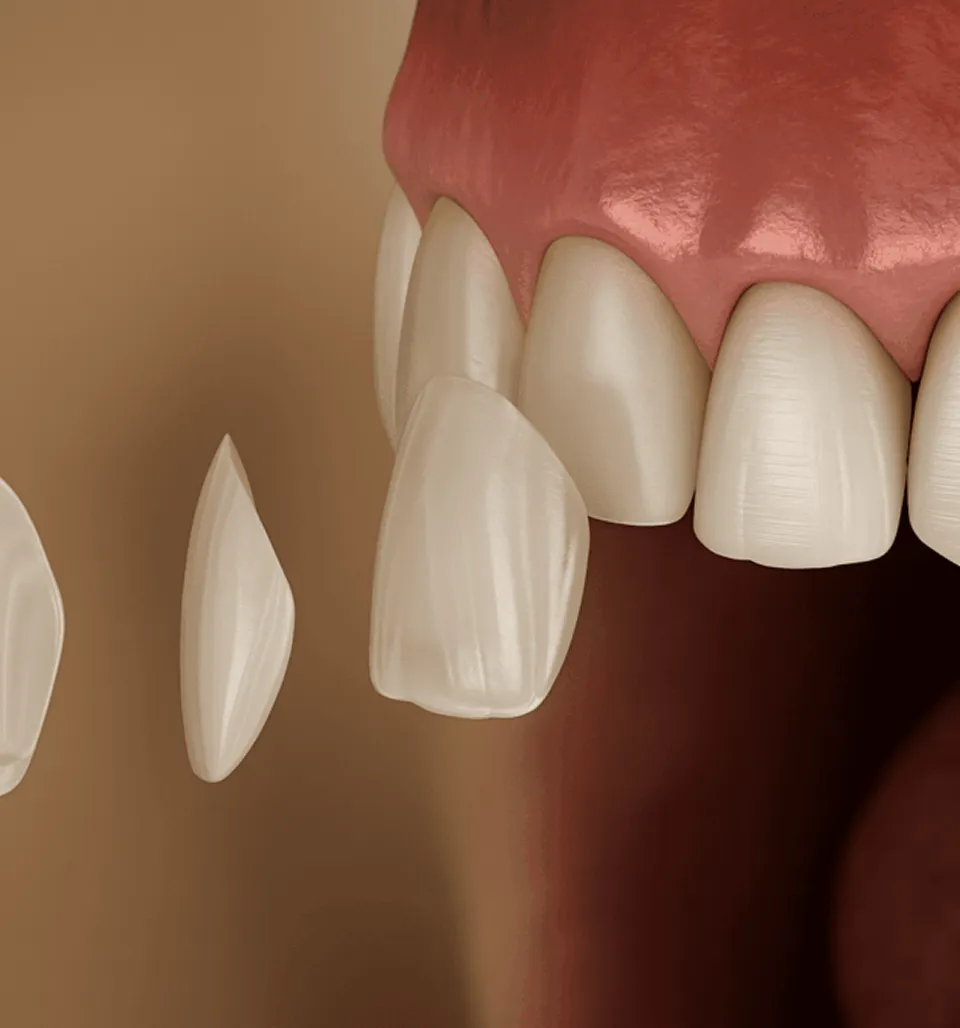 Westwood Dental Esthetics