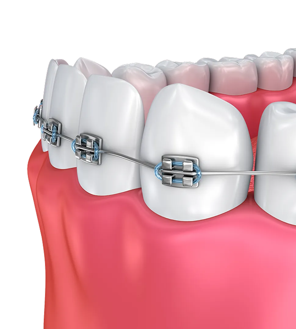 Westwood Dental Esthetics