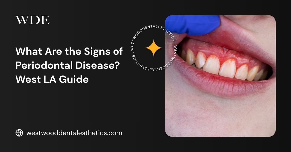 Close-up of red, swollen gums with visible inflammation, an early sign commonly associated with periodontal disease.